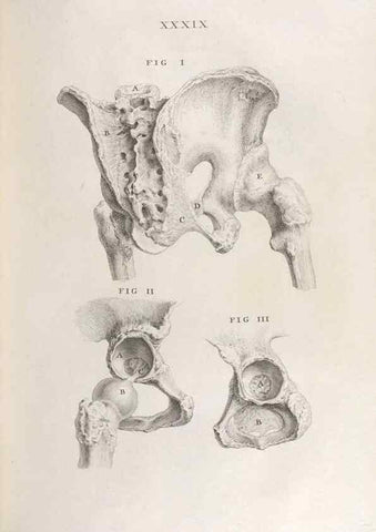 Reproducción/Reproduction 48832441118: Osteographia, or the Anatomy of the Bones.. London,1733.. 