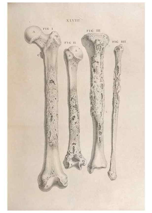 Reproducción/Reproduction 48832980897: Osteographia, or the Anatomy of the Bones.. London,1733.. 