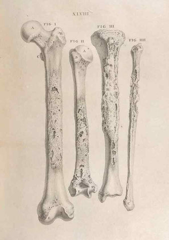 Reproducción/Reproduction 48832980897: Osteographia, or the Anatomy of the Bones.. London,1733.. 