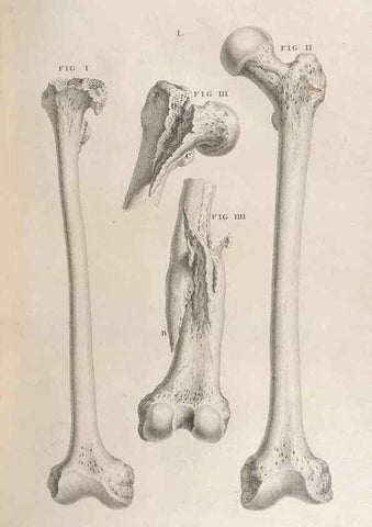 Reproducción/Reproduction 48832811051: Osteographia, or the Anatomy of the Bones.. London,1733.. 