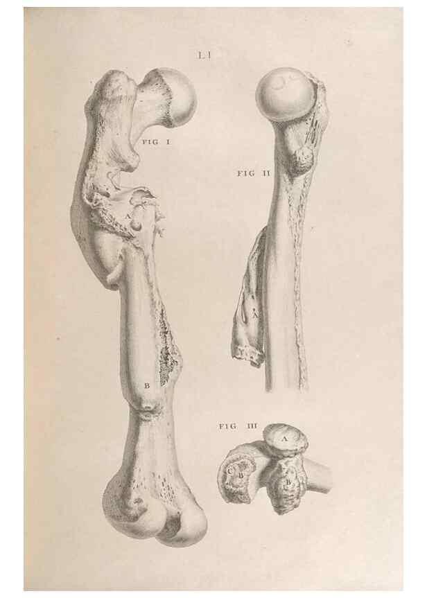 Reproducción/Reproduction 48832811376: Osteographia, or the Anatomy of the Bones.. London,1733.. 