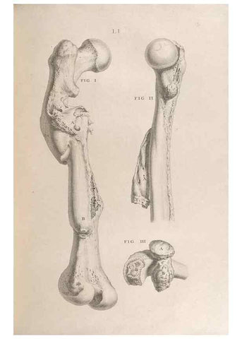 Reproducción/Reproduction 48832811376: Osteographia, or the Anatomy of the Bones.. London,1733.. 
