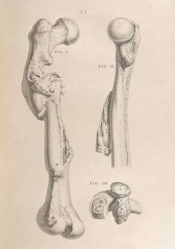 Reproducción/Reproduction 48832811376: Osteographia, or the Anatomy of the Bones.. London,1733.. 