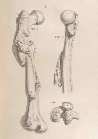 Reproducción/Reproduction 48832811376: Osteographia, or the Anatomy of the Bones.. London,1733.. 