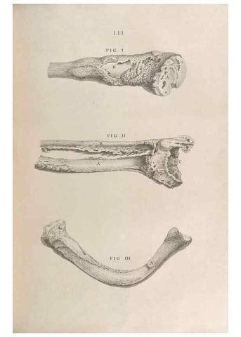Reproducción/Reproduction 48832982077: Osteographia, or the Anatomy of the Bones.. London,1733.. 