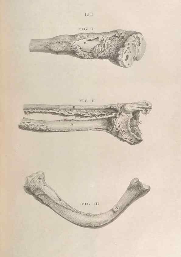 Reproducción/Reproduction 48832982077: Osteographia, or the Anatomy of the Bones.. London,1733.. 