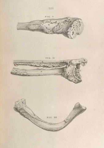 Reproducción/Reproduction 48832982077: Osteographia, or the Anatomy of the Bones.. London,1733.. 
