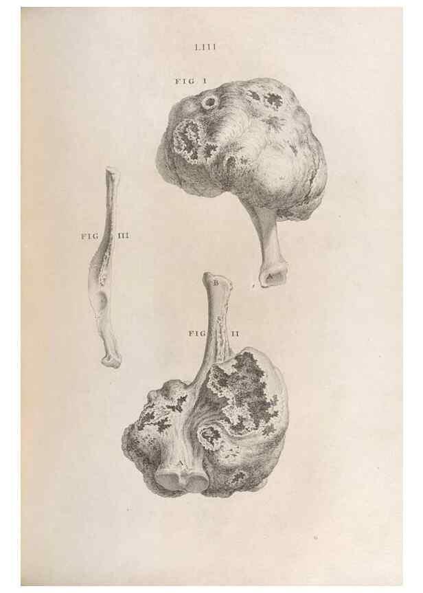 Reproducción/Reproduction 48832446038: Osteographia, or the Anatomy of the Bones.. London,1733.. 