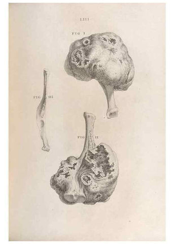 Reproducción/Reproduction 48832446038: Osteographia, or the Anatomy of the Bones.. London,1733.. 