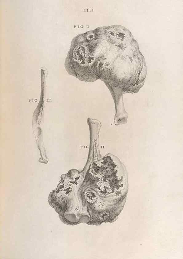 Reproducción/Reproduction 48832446038: Osteographia, or the Anatomy of the Bones.. London,1733.. 