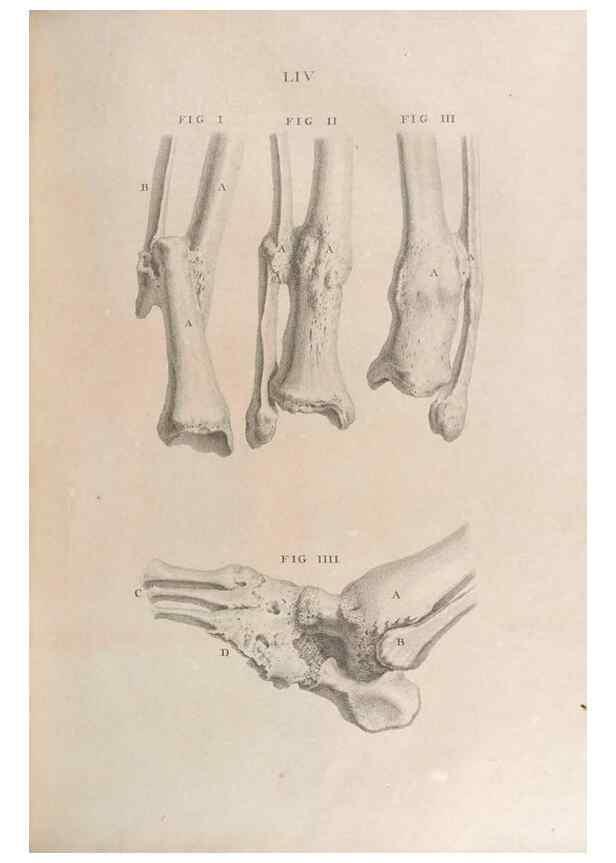 Reproducción/Reproduction 48832812476: Osteographia, or the Anatomy of the Bones.. London,1733.. 