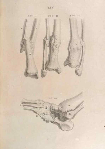 Reproducción/Reproduction 48832812476: Osteographia, or the Anatomy of the Bones.. London,1733.. 