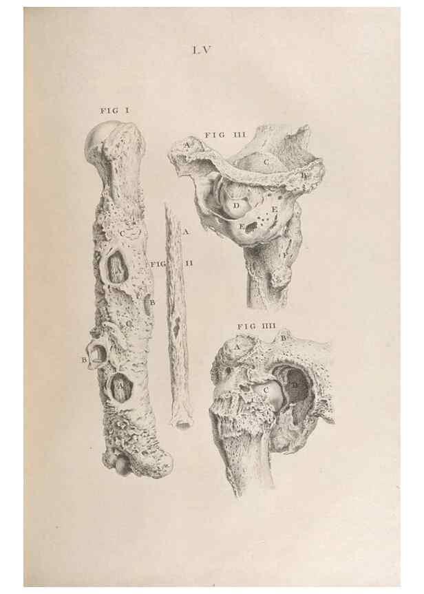 Reproducción/Reproduction 48832446753: Osteographia, or the Anatomy of the Bones.. London,1733.. 