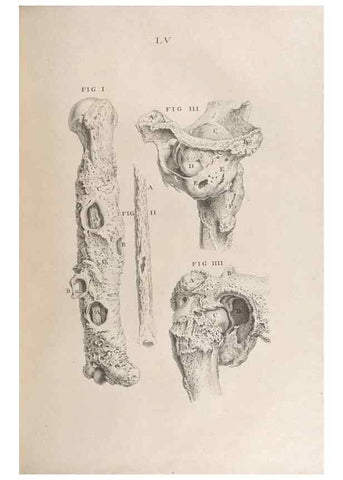 Reproducción/Reproduction 48832446753: Osteographia, or the Anatomy of the Bones.. London,1733.. 