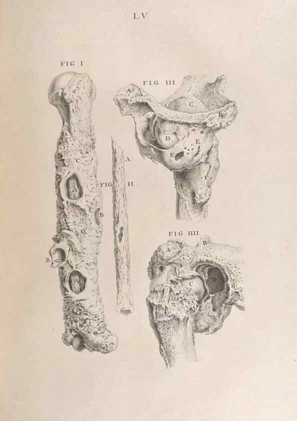 Reproducción/Reproduction 48832446753: Osteographia, or the Anatomy of the Bones.. London,1733.. 