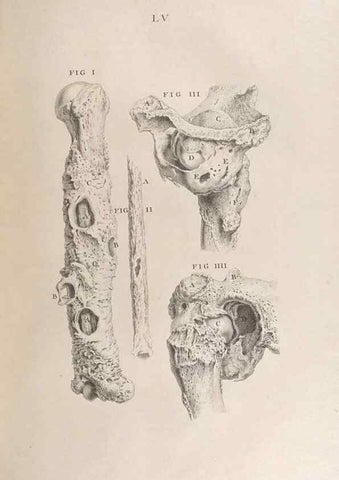 Reproducción/Reproduction 48832446753: Osteographia, or the Anatomy of the Bones.. London,1733.. 