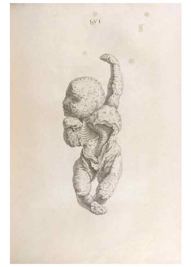 Reproducción/Reproduction 48832447063: Osteographia, or the Anatomy of the Bones.. London,1733.. 