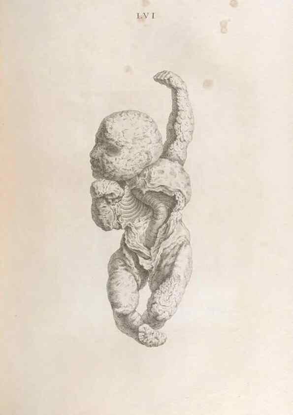 Reproducción/Reproduction 48832447063: Osteographia, or the Anatomy of the Bones.. London,1733.. 