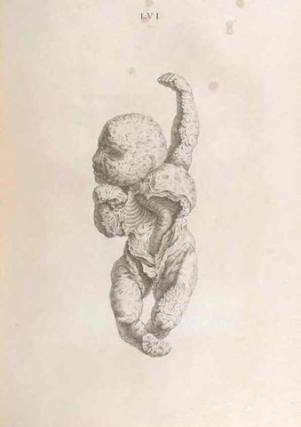 Reproducción/Reproduction 48832447063: Osteographia, or the Anatomy of the Bones.. London,1733.. 