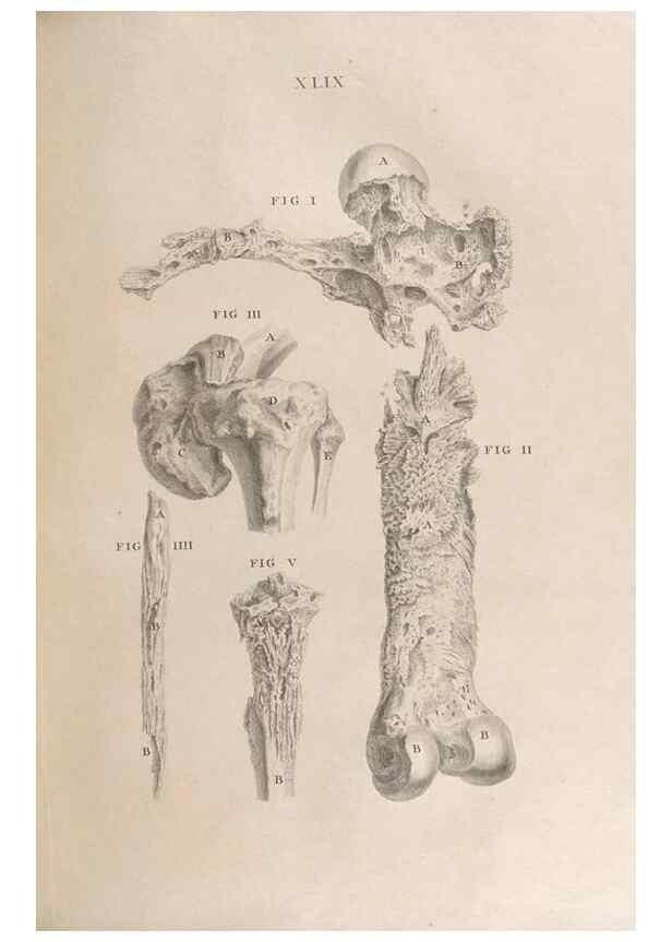 Reproducción/Reproduction 48832981217: Osteographia, or the Anatomy of the Bones.. London,1733.. 