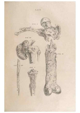 Reproducción/Reproduction 48832981217: Osteographia, or the Anatomy of the Bones.. London,1733.. 
