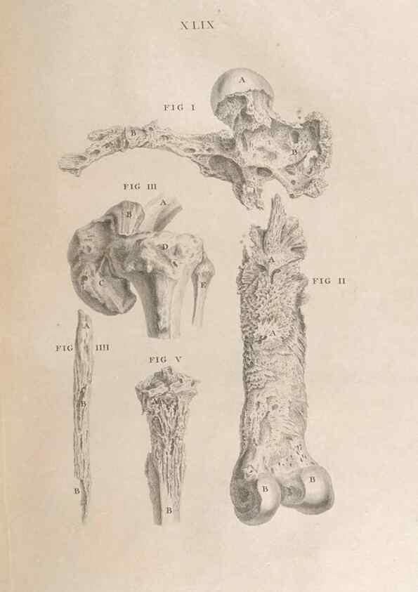 Reproducción/Reproduction 48832981217: Osteographia, or the Anatomy of the Bones.. London,1733.. 