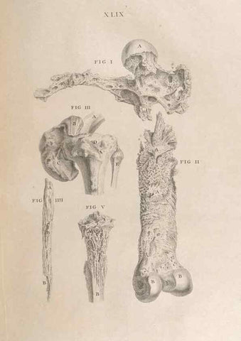 Reproducción/Reproduction 48832981217: Osteographia, or the Anatomy of the Bones.. London,1733.. 