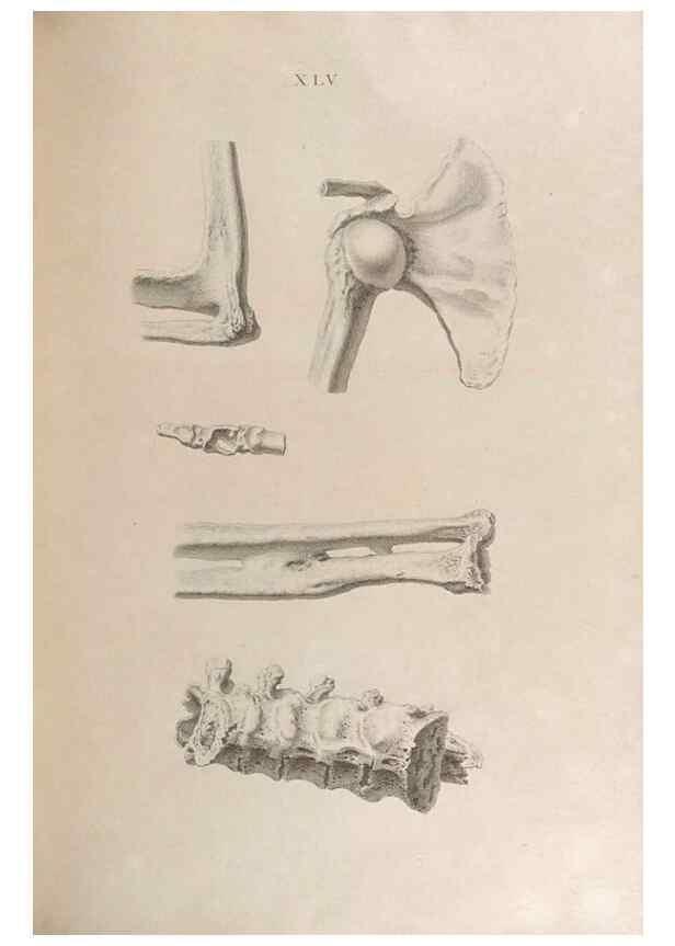 Reproducción/Reproduction 48832828666: Osteographia, or the Anatomy of the Bones.. London,1733.. 