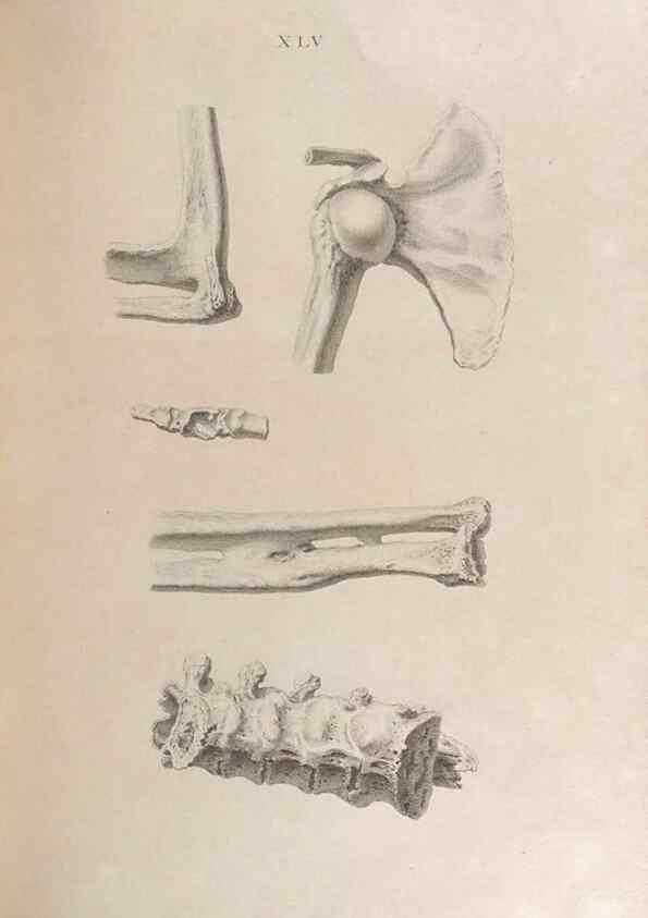 Reproducción/Reproduction 48832828666: Osteographia, or the Anatomy of the Bones.. London,1733.. 