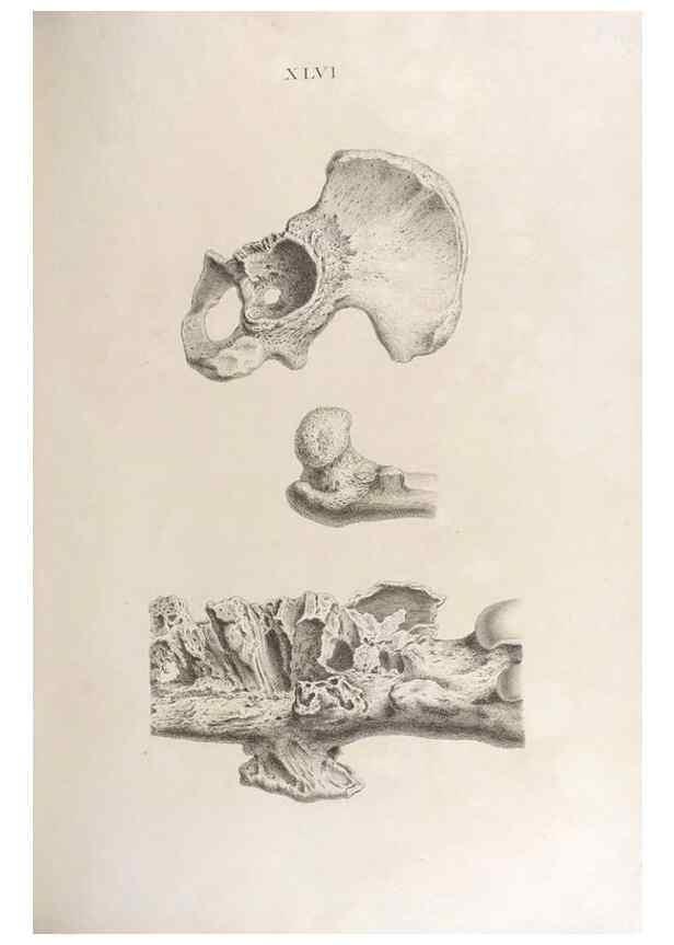 Reproducción/Reproduction 48832829046: Osteographia, or the Anatomy of the Bones.. London,1733.. 