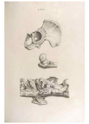 Reproducción/Reproduction 48832829046: Osteographia, or the Anatomy of the Bones.. London,1733.. 
