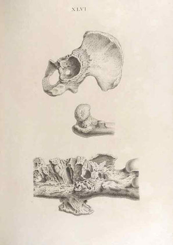 Reproducción/Reproduction 48832829046: Osteographia, or the Anatomy of the Bones.. London,1733.. 