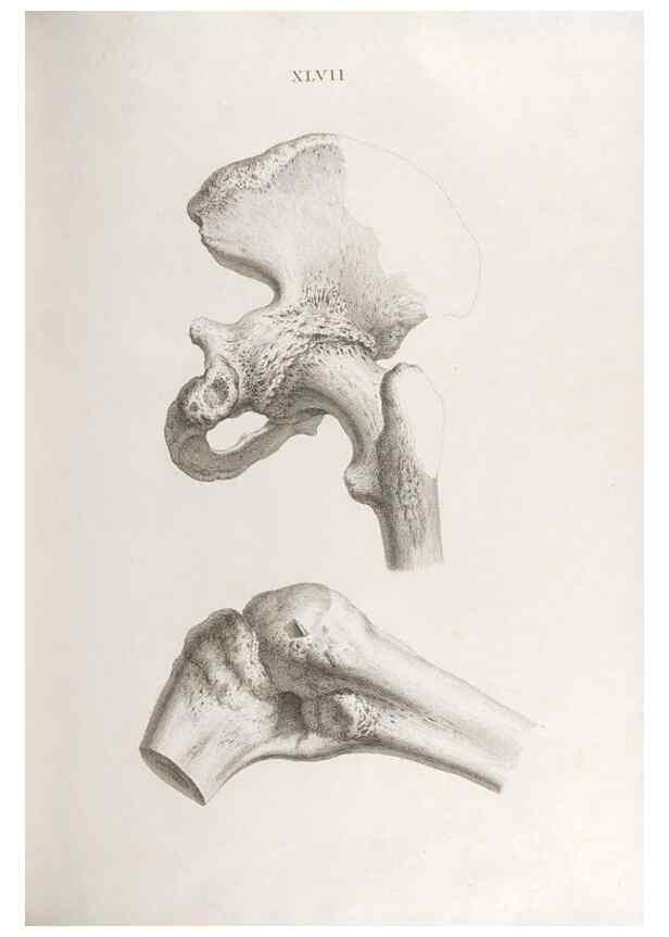 Reproducción/Reproduction 48832463783: Osteographia, or the Anatomy of the Bones.. London,1733.. 