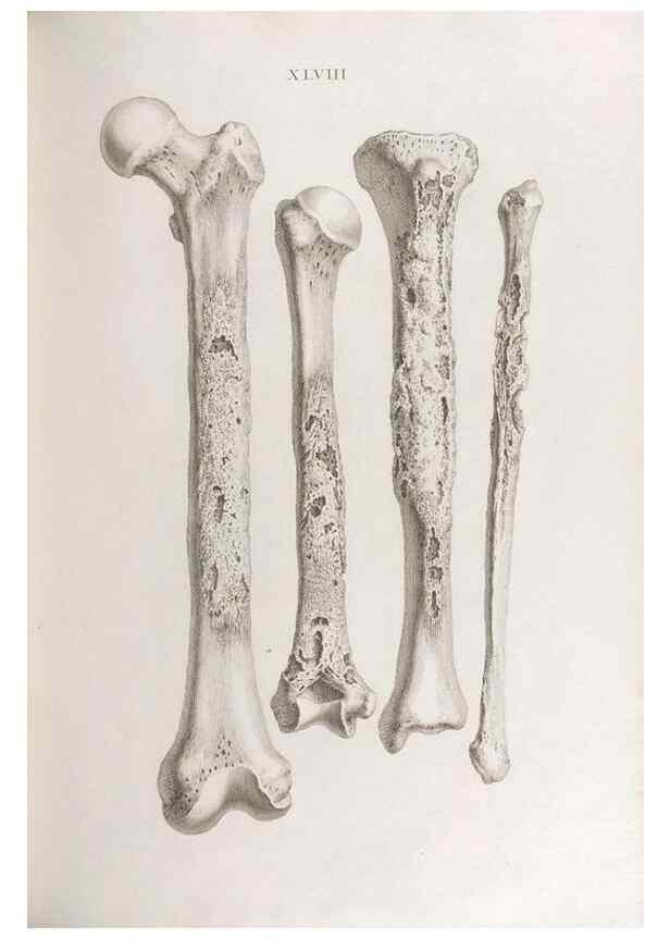 Reproducción/Reproduction 48832464163: Osteographia, or the Anatomy of the Bones.. London,1733.. 