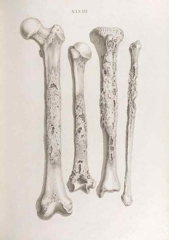 Reproducción/Reproduction 48832464163: Osteographia, or the Anatomy of the Bones.. London,1733.. 