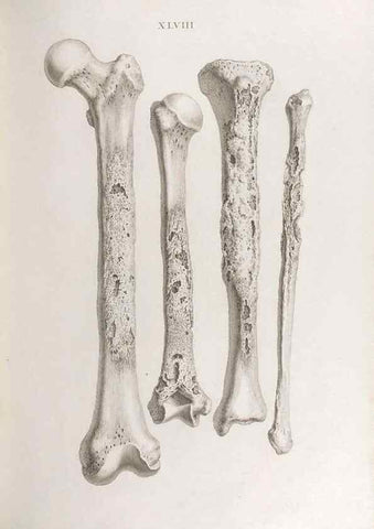 Reproducción/Reproduction 48832464163: Osteographia, or the Anatomy of the Bones.. London,1733.. 