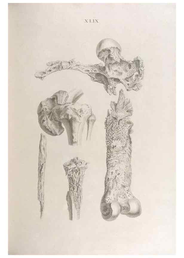 Reproducción/Reproduction 48832830376: Osteographia, or the Anatomy of the Bones.. London,1733.. 