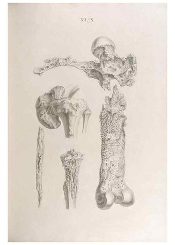 Reproducción/Reproduction 48832830376: Osteographia, or the Anatomy of the Bones.. London,1733.. 