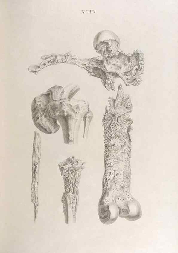 Reproducción/Reproduction 48832830376: Osteographia, or the Anatomy of the Bones.. London,1733.. 