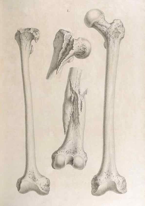 Reproducción/Reproduction 48832465078: Osteographia, or the Anatomy of the Bones.. London,1733.. 