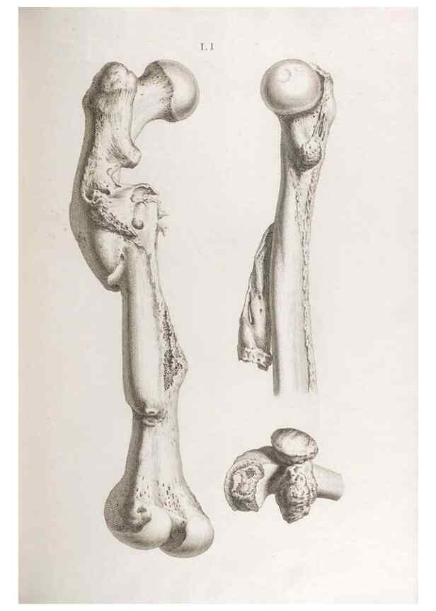 Reproducción/Reproduction 48833001342: Osteographia, or the Anatomy of the Bones.. London,1733.. 