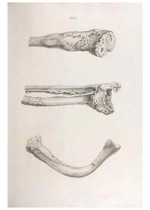 Reproducción/Reproduction 48833001652: Osteographia, or the Anatomy of the Bones.. London,1733.. 