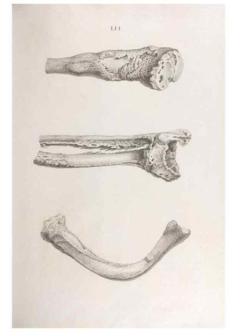Reproducción/Reproduction 48833001652: Osteographia, or the Anatomy of the Bones.. London,1733.. 