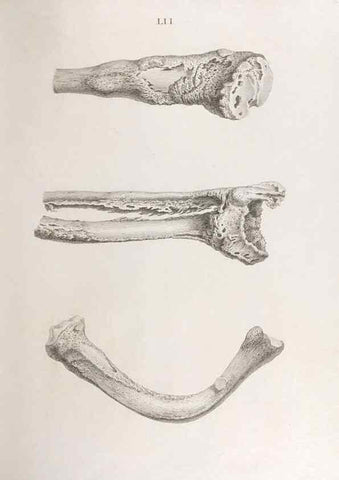 Reproducción/Reproduction 48833001652: Osteographia, or the Anatomy of the Bones.. London,1733.. 