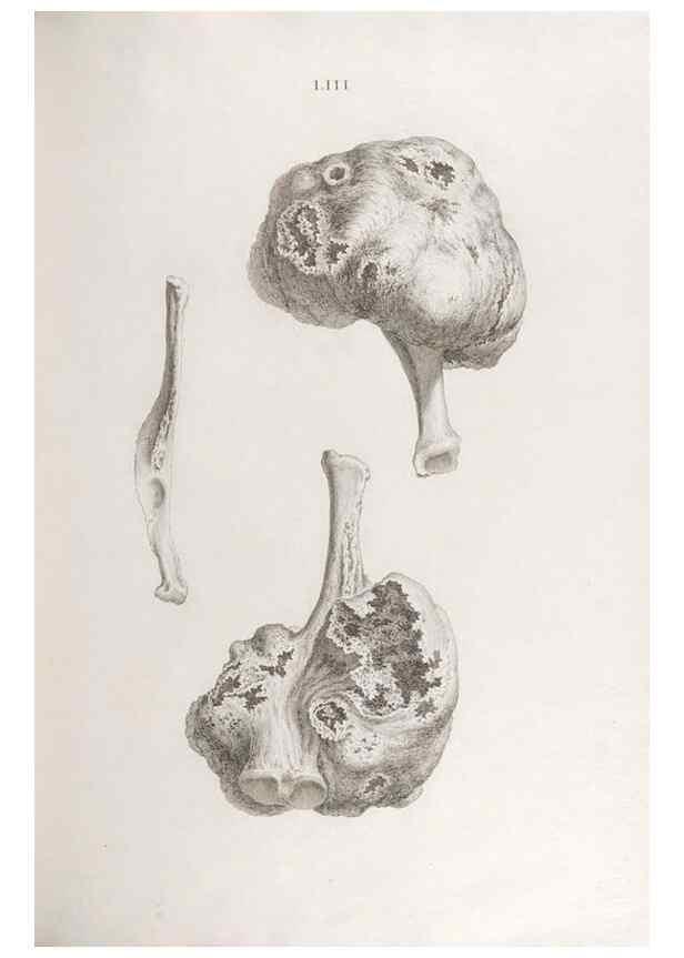 Reproducción/Reproduction 48832466293: Osteographia, or the Anatomy of the Bones.. London,1733.. 