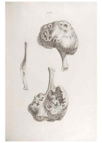 Reproducción/Reproduction 48832466293: Osteographia, or the Anatomy of the Bones.. London,1733.. 
