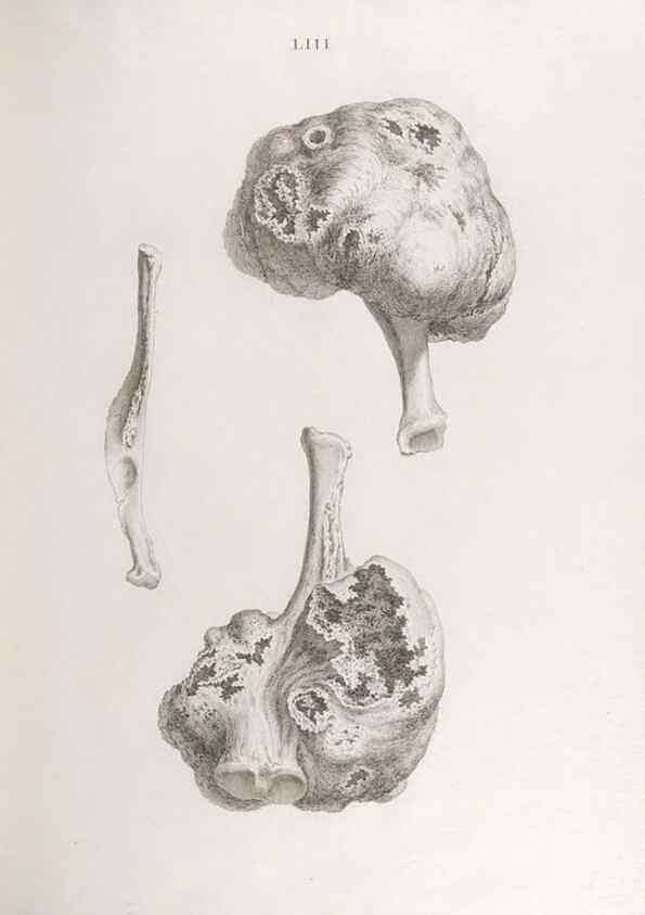 Reproducción/Reproduction 48832466293: Osteographia, or the Anatomy of the Bones.. London,1733.. 
