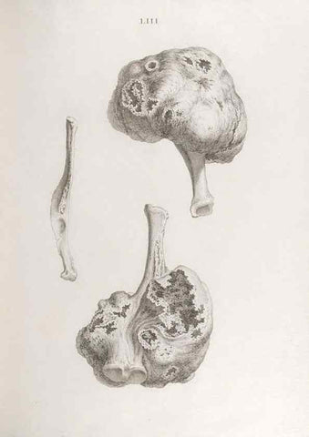 Reproducción/Reproduction 48832466293: Osteographia, or the Anatomy of the Bones.. London,1733.. 