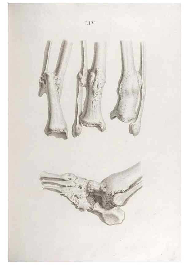 Reproducción/Reproduction 48832466723: Osteographia, or the Anatomy of the Bones.. London,1733.. 