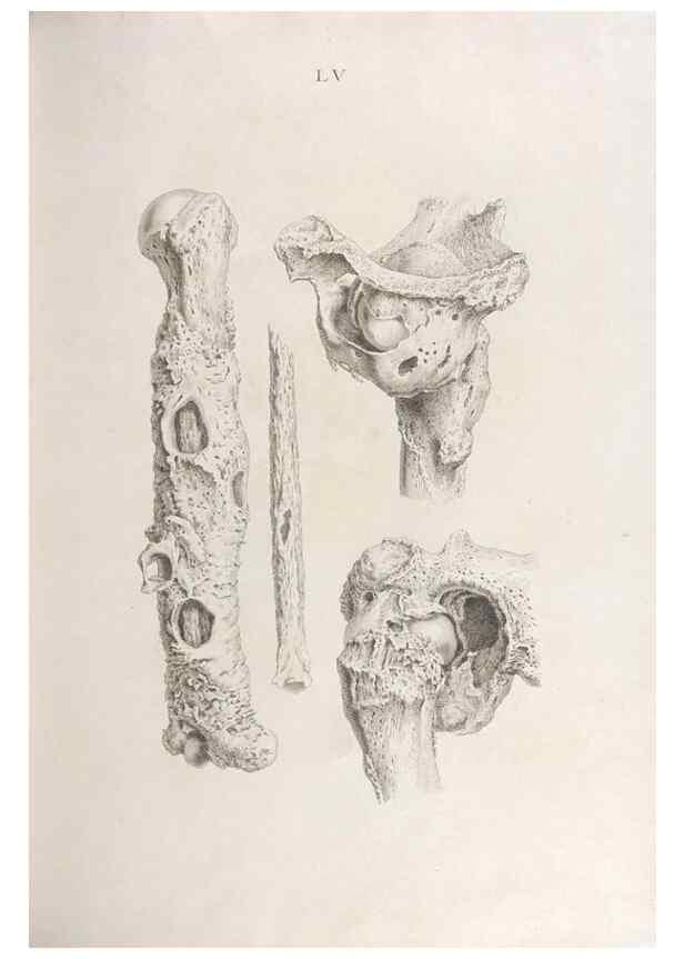 Reproducción/Reproduction 48832832946: Osteographia, or the Anatomy of the Bones.. London,1733.. 
